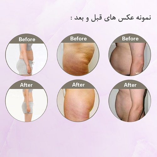 لاغری2